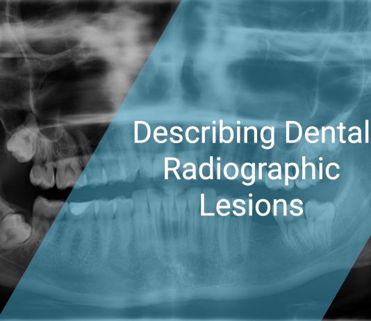 Describing Dental Radiographic Lesions