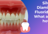 Silver Diamine Fluoride (SDF) – What is it and How do you use it?