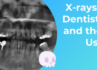 Dental X-rays and their Uses